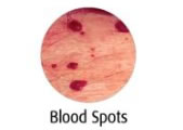 Blood-Spots-Blemish Removal