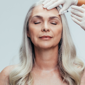 botox injections Teddington the skin nurse