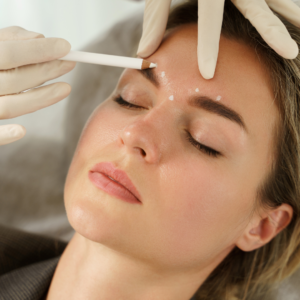what is botox and how does it work? Botox Teddington